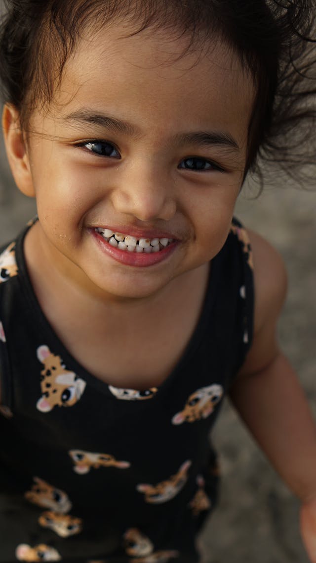 Tanda-Tanda Karies Gigi pada Bayi